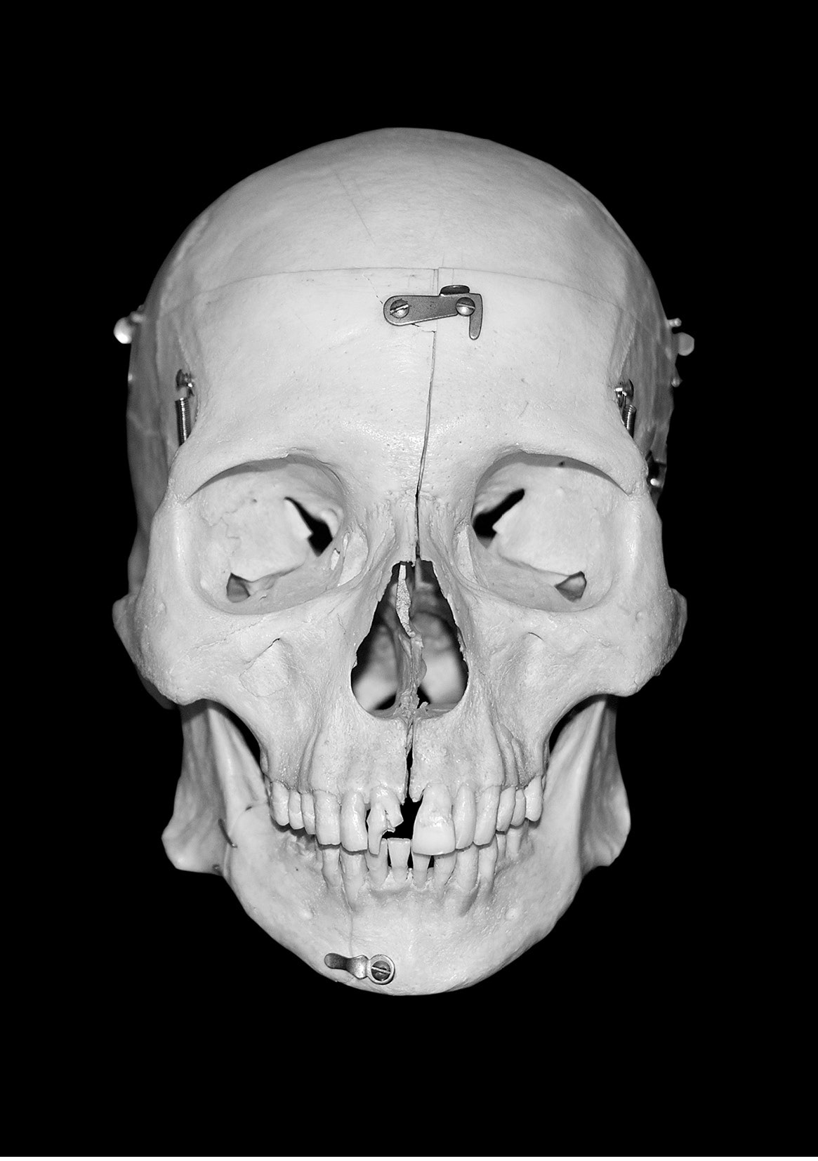 Black & White Skull | Digitale Fotoretusche