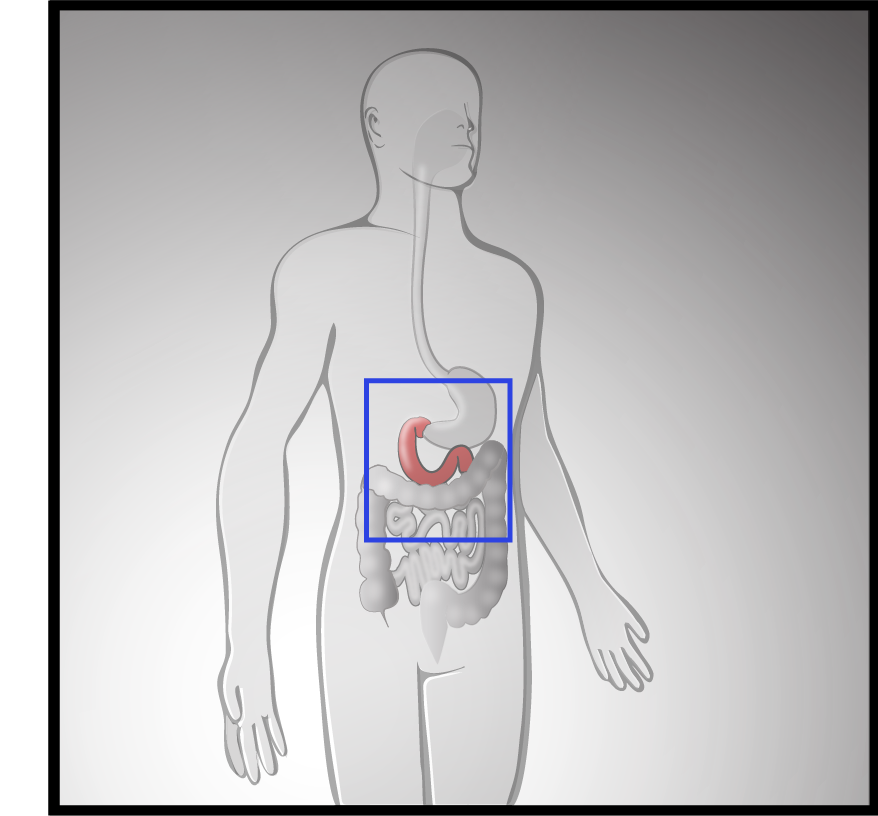 Opening scene - showing model and area for zoom