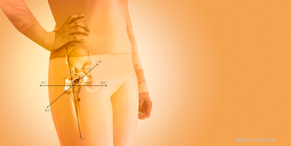 Zimmer, artificial hip joint.